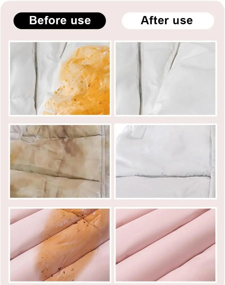 Stain Removal Wet Wipes rj8m7q-57